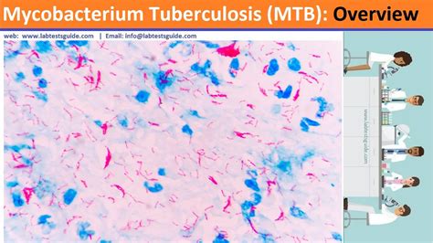 Mycobacterium Tuberculosis Mtb Mtb Overview Lab Tests Guide Nbkomputer