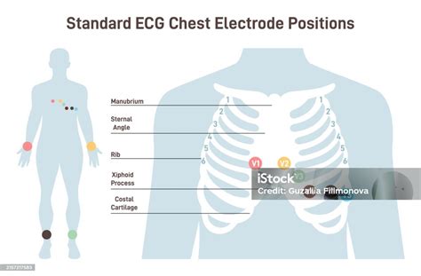 Position Of Ecg Chest Leads Cardiovascular Checkup With Cardiogram