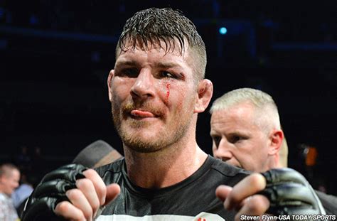 UFC middleweight Michael Bisping undergoes elbow surgery, return date ...