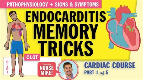 Endocarditis With Comprehensive Nclex Review At Simplenursing