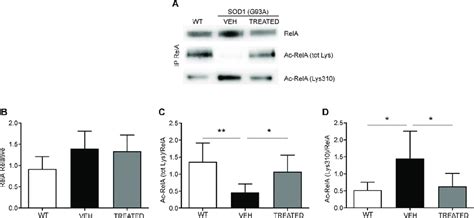 Immunoprecipitation And Densitometric Analysis Of Rela Acetylation In