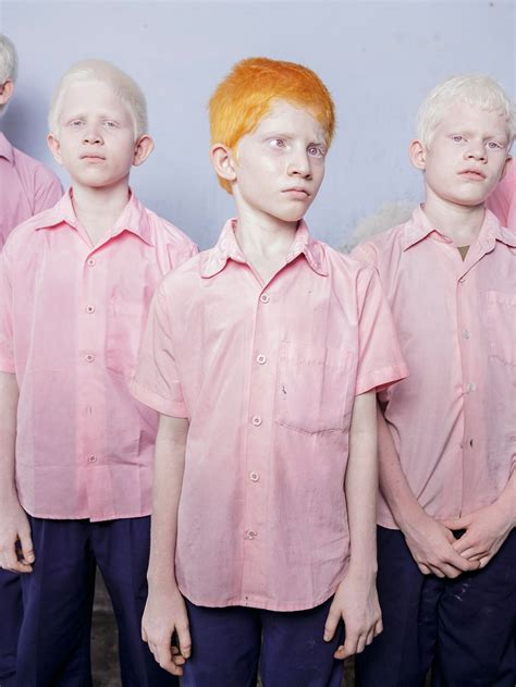 Men From Mars Albino Twins