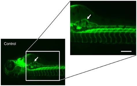 Comparison Of Effects Of Anti Angiogenic Agents In The Zebrafish Effic