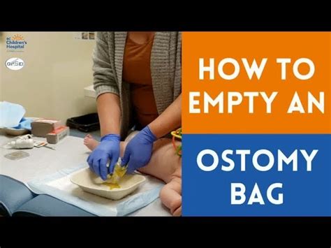 The Secret Of Info About How To Clean Ostomy Bag Welfareburn20