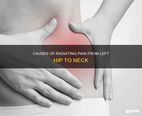 Causes Of Radiating Pain From Left Hip To Neck Medshun