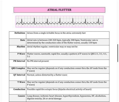 Dysrhythmia Cheat Sheet