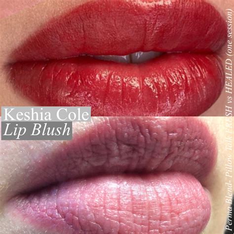 Everything You Need To Know About Lip Blush Treatment Kcole Studio