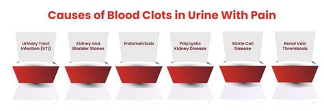 Blood Clots In Urine Symptoms And Causes Fastdocnow