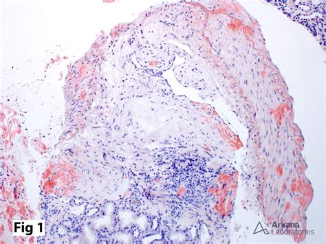 Congo Red Stain | Teaching Points | Arkana Laboratories