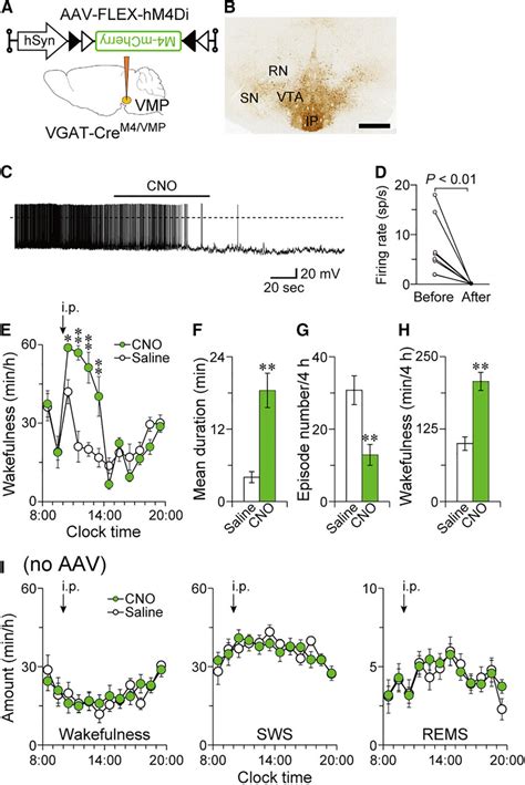 Chemogenetic Inhibition Of The VMP GABAergic Neurons Increased