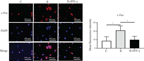 IFN γ inhibited osteoclastogenesis by suppressing RANKL mediated