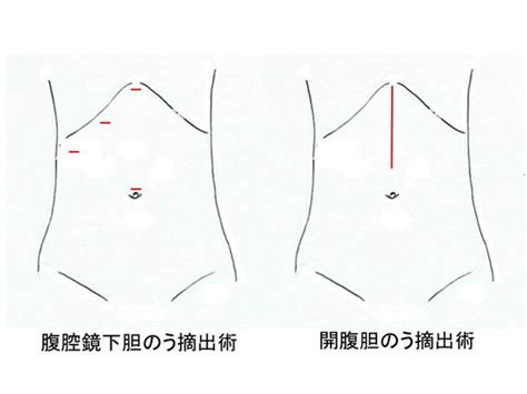 腹腔鏡手術 医療法人社団 杉原会 西福山病院