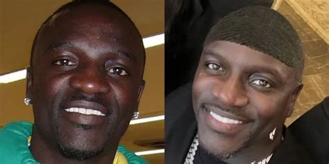 Akon's Incredible Hair Journey - Hair System