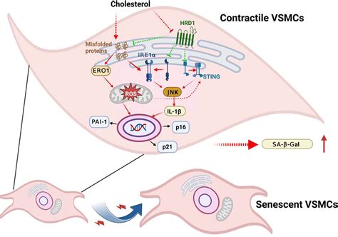 Cholesterol Induced Hrd Reduction Accelerates Vascular Smooth Muscle