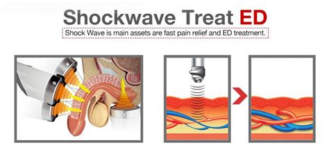 New generation shockwave therapy device body joint and ED treatment