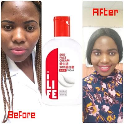 Greenleaf Biotech International: Greenleaf SOD Face Cream Testimony