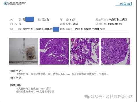 纵裂入路及镰旁脑膜瘤的手术治疗 脑医汇 神外资讯 神介资讯