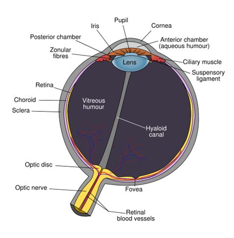 Hyphema - wikidoc