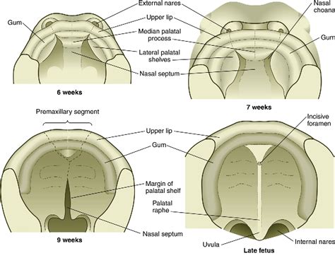 cheiloplasty | Semantic Scholar