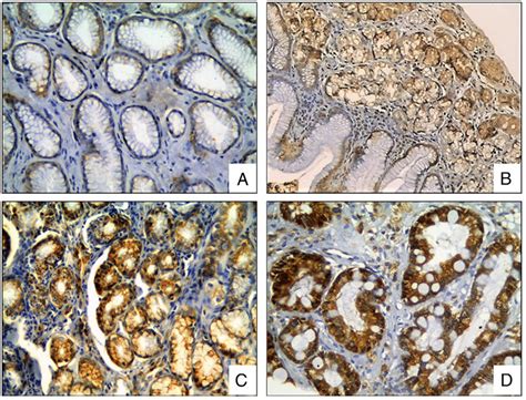 Cox Immunohistochemical Staining In Gastric Biopsies With Mucosal