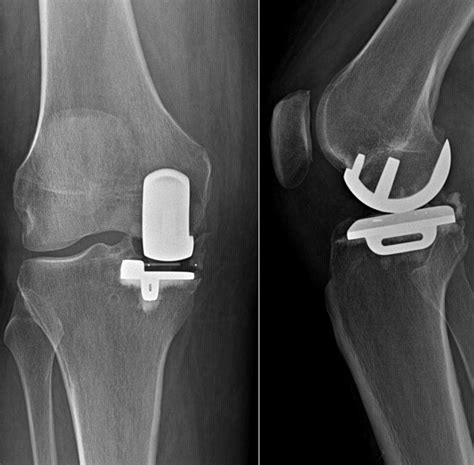 Knee Systems Atlas — Hip And Knee Book