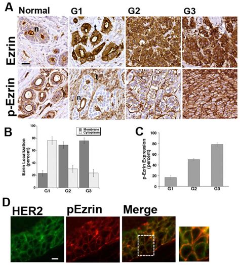 Analysis Of Ezrin And P T Ezrin Expression And Localization In