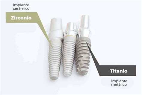 Implantes de zirconio vs titanio Cuál es el más adecuado RESYCAM