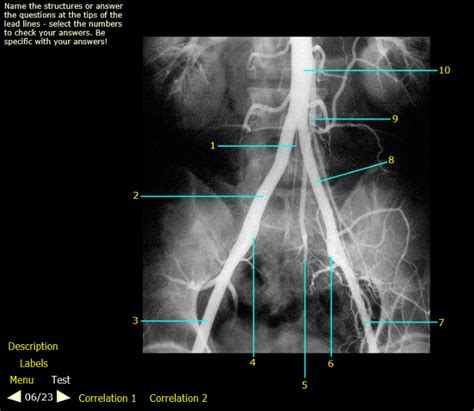 Pelvic Arterial Anatomy Angiogram Human Anatomy