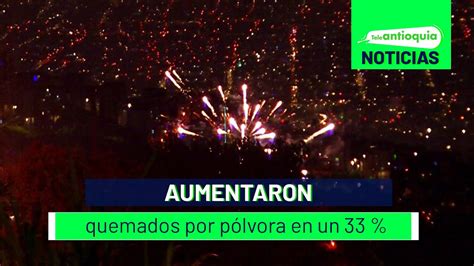 Aumentaron quemados por pólvora en un 33 Teleantioquia Noticias