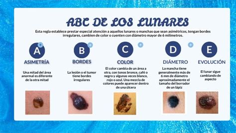 Abc De Los Lunares