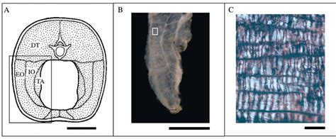 Collagen Fiber Orientation Within Hypaxial Myosepta A Transverse