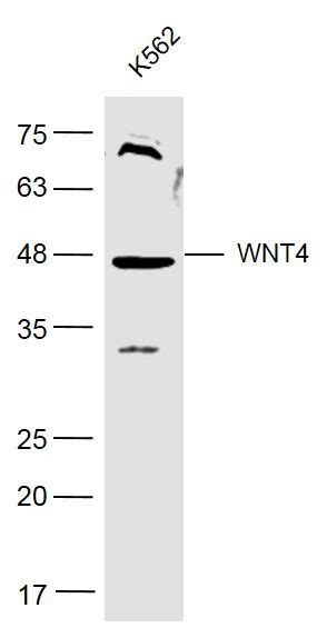 Wnt Lab On Web