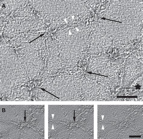 Figure 2 From Native Ultrastructure Of The Red Cell Cytoskeleton By