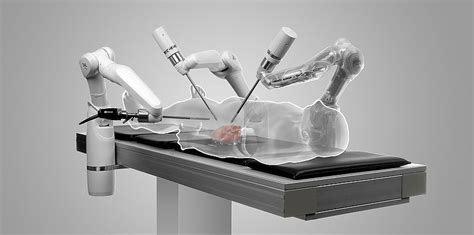 Mirosurge Robotic System For Minimally Invasive Surgery Robotic Gizmos