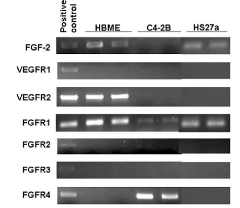 Vegfr Flk And Fgfr Mrna Expression In Bme Cells Using Rt Pcr As