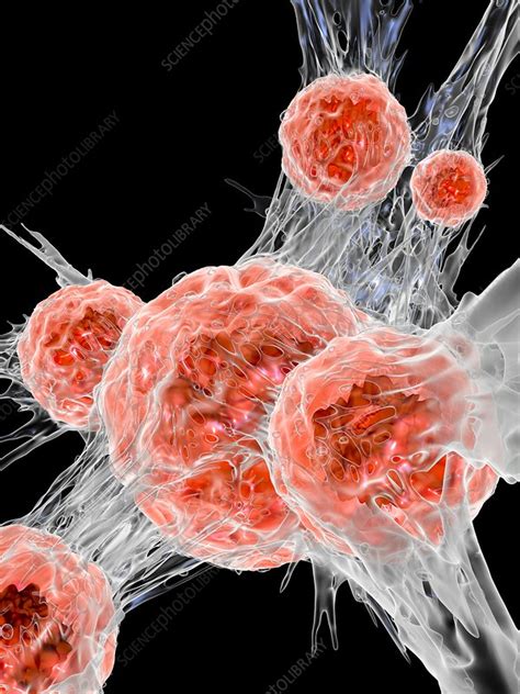 Cancer Cell Illustration Stock Image C029 5232 Science Photo Library