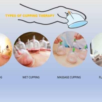 Types of Cupping therapy | Download Scientific Diagram