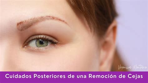 Cuidados Posteriores De Una Remoci N De Cejas Youtube