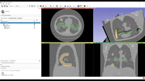 Convert Mhd Dose Volume To RTDose File And Export Support 3D