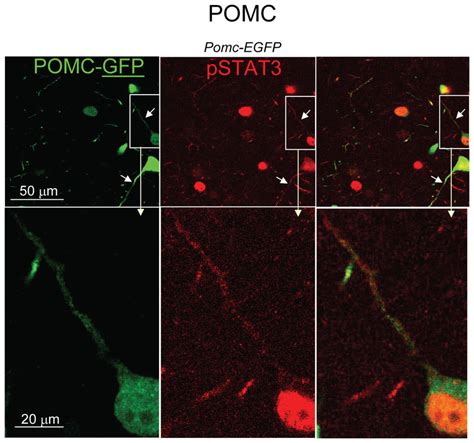 Leptin Activates Stat3 Phosphorylation In Soma And Processes Of Download Scientific Diagram