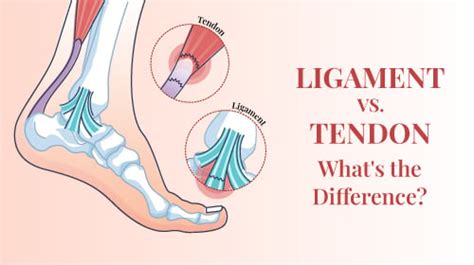 Difference Between Tendons And Ligaments Rela Hospital