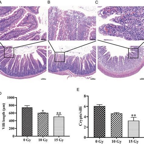 Establishment Of An Abdominal Irradiation Induced Intestinal Injury