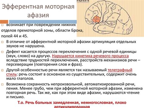 Афазия - online presentation