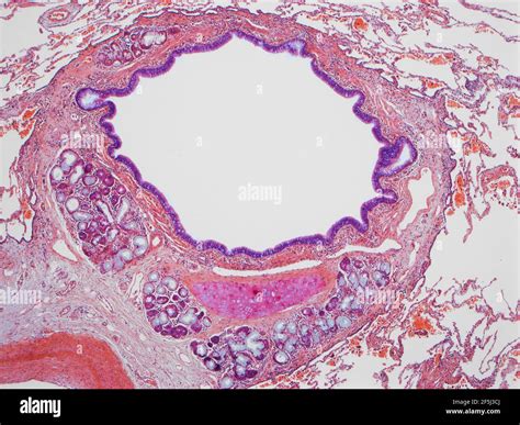 Bronchioles Histology