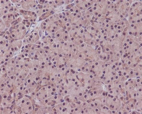 Pp Alpha Beta Catalytic Subunit Antibody Sr Novus Biologicals