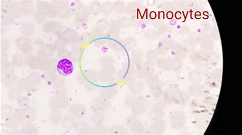 Monocytes Under Microscope Youtube