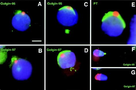 Vesicular Traffic And Golgi Apparatus Dynamics During Mammalian