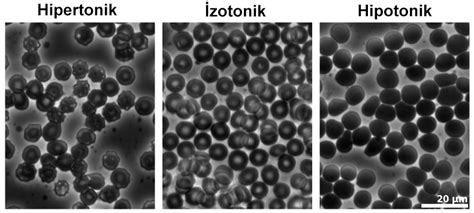 Hipertonik Ortam Nedir Evrim A Ac