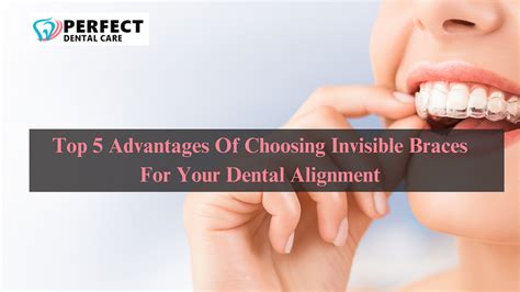 Top 5 Advantages Of Choosing Invisible Braces For Your Dental Alignment