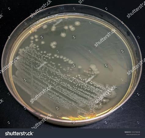 E Coli Streak Plate